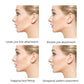 Invisible Face Lifting Tapes - Pack of 40 Pcs