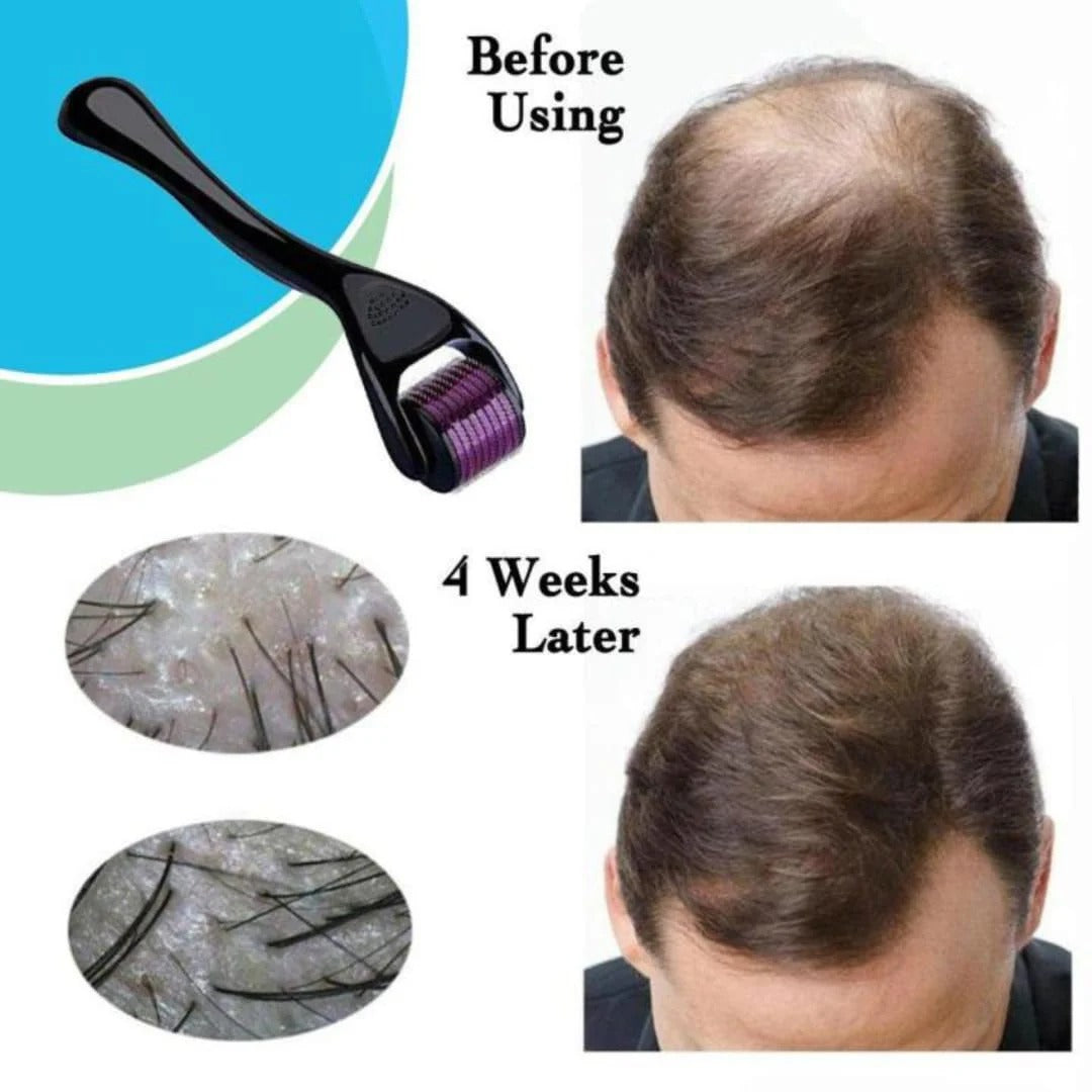 Derma Roller – At-Home Skin Care Tool for Daily Routine