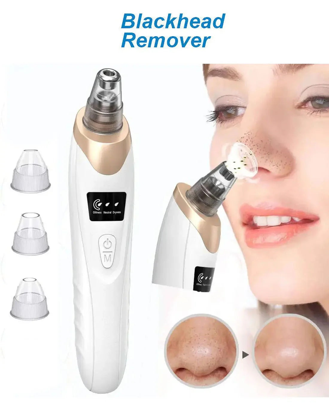 USB Rechargeable Blackhead Remover