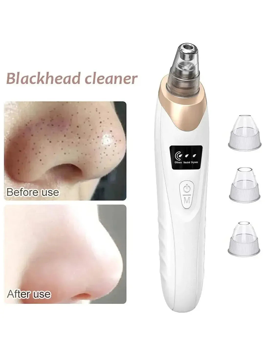 USB Rechargeable Blackhead Remover