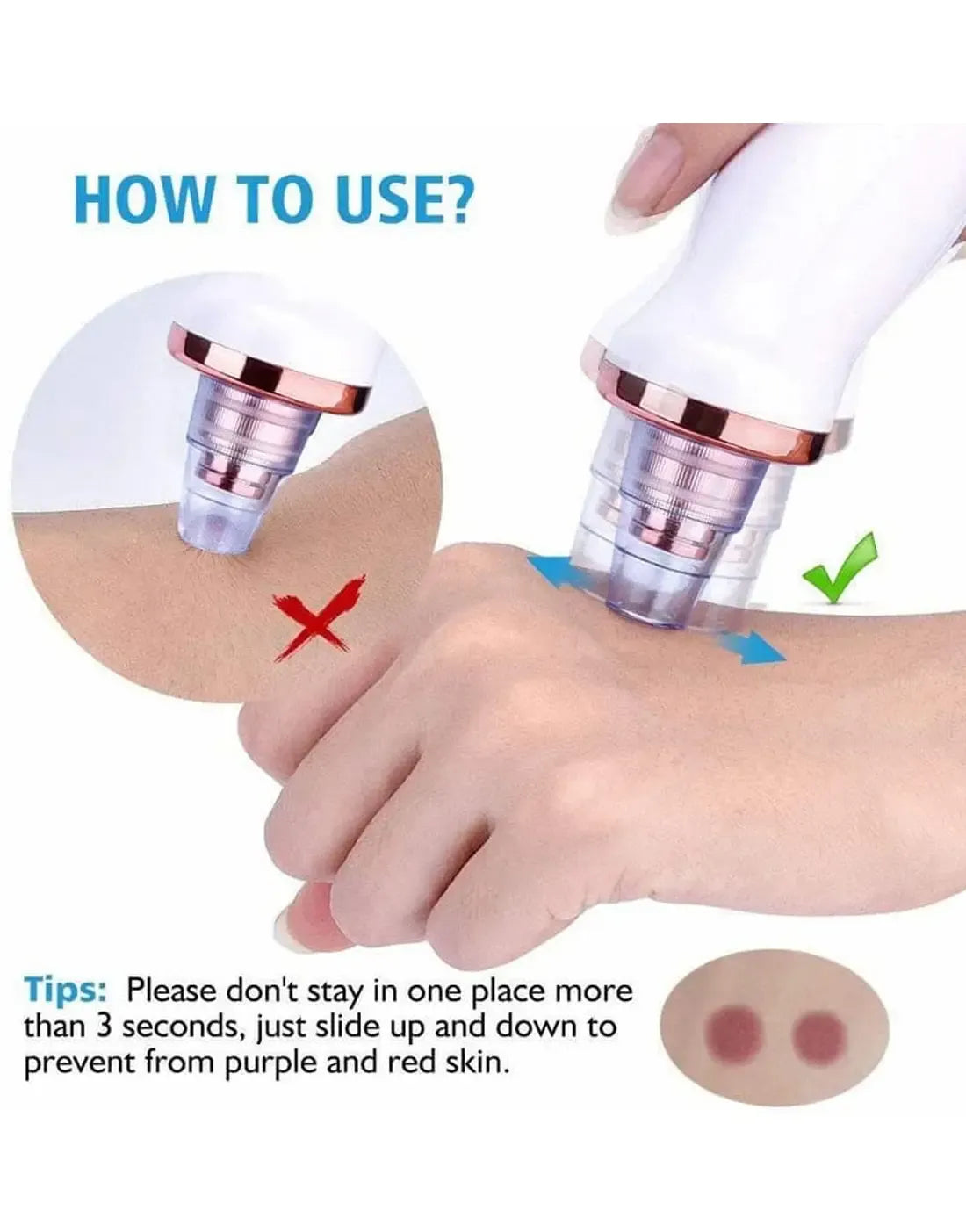 USB Rechargeable Blackhead Remover